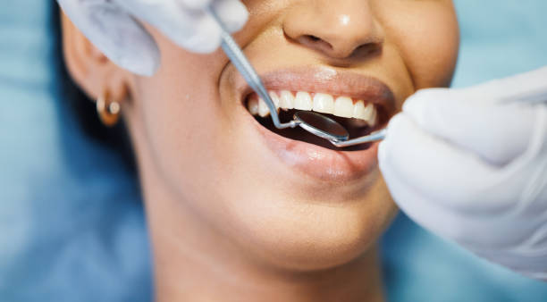 Best Emergency Dental Care for Sports Injuries in Severn, MD
