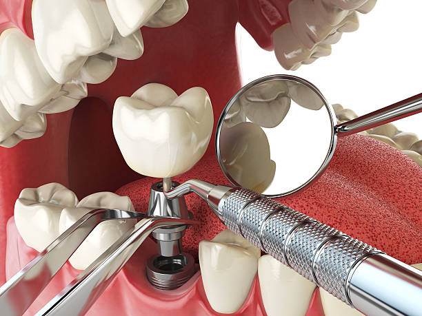 Best 24-Hour Emergency Dental Care in Severn, MD